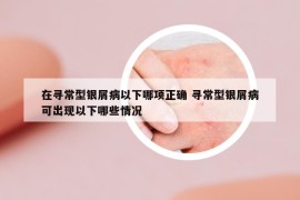 在寻常型银屑病以下哪项正确 寻常型银屑病可出现以下哪些情况