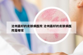 沧州最好的皮肤病医院 沧州最好的皮肤病医院是哪家