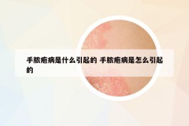 手脓疱病是什么引起的 手脓疱病是怎么引起的