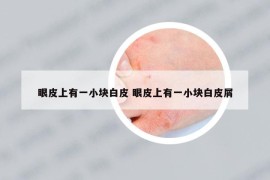 眼皮上有一小块白皮 眼皮上有一小块白皮屑