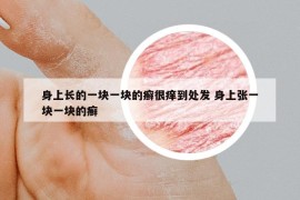 身上长的一块一块的癣很痒到处发 身上张一块一块的癣