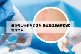 云克和生物制剂的区别 云克和生物制剂的区别是什么