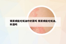 银屑病能吃蚝油炒的菜吗 银屑病能吃蚝油,料酒吗