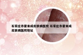 石家庄市霍来成皮肤病医院 石家庄市霍来成皮肤病医院地址