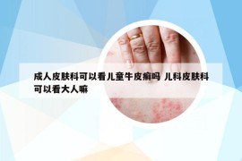 成人皮肤科可以看儿童牛皮癣吗 儿科皮肤科可以看大人嘛