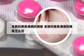 皮肤科银屑病病历模板 皮肤科银屑病病历模板怎么写