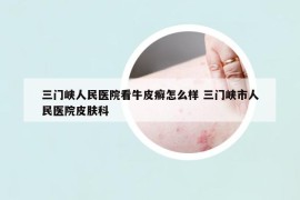 三门峡人民医院看牛皮癣怎么样 三门峡市人民医院皮肤科