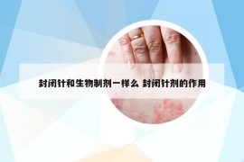 封闭针和生物制剂一样么 封闭针剂的作用