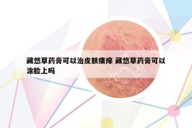 藏悠草药膏可以治皮肤瘙痒 藏悠草药膏可以涂脸上吗