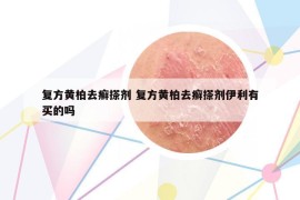 复方黄柏去癣搽剂 复方黄柏去癣搽剂伊利有买的吗