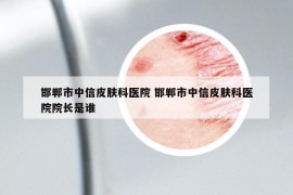 邯郸市中信皮肤科医院 邯郸市中信皮肤科医院院长是谁
