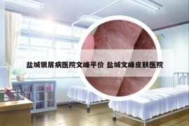 盐城银屑病医院文峰平价 盐城文峰皮肤医院