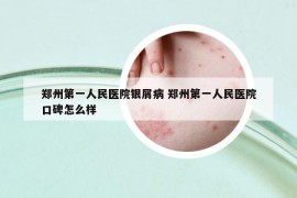 郑州第一人民医院银屑病 郑州第一人民医院口碑怎么样