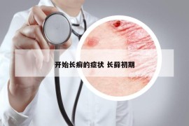 开始长癣的症状 长藓初期