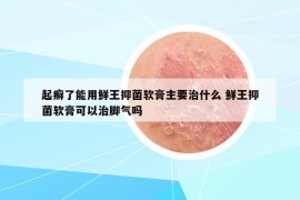 起癣了能用鲜王抑菌软膏主要治什么 鲜王抑菌软膏可以治脚气吗