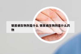 银屑病生物剂是什么 银屑病生物剂是什么药物