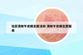 社区清除牛皮癣主题活动 清除牛皮癣志愿服务
