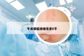 牛皮癣能抹维生素E不