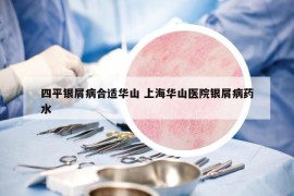 四平银屑病合适华山 上海华山医院银屑病药水