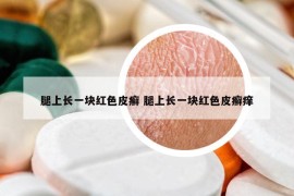 腿上长一块红色皮癣 腿上长一块红色皮癣痒