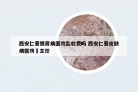 西安仁爱银屑病医院乱收费吗 西安仁爱皮肤病医院祃主任