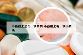 小孩脸上总长一块白的 小孩脸上有一块小白块