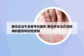 廊坊主治牛皮癣专科医院 廊坊市有治疗皮肤病的医院吗的短视频