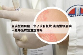 点滴型银屑病一辈子没有复发 点滴型银屑病一辈子没有复发正常吗