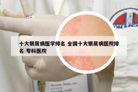 十大银屑病医学排名 全国十大银屑病医院排名 专科医院
