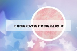 七寸拔癣膏多少钱 七寸拔癣膏正规厂家