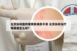 北京协和医院看银屑病贵不贵 北京协和治疗银屑病怎么样?