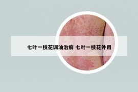 七叶一枝花调油治癣 七叶一枝花外用