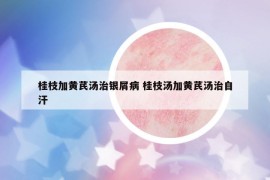 桂枝加黄芪汤治银屑病 桂枝汤加黄芪汤治自汗