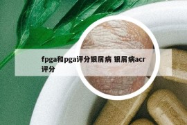 fpga和pga评分银屑病 银屑病acr评分