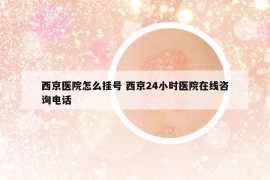 西京医院怎么挂号 西京24小时医院在线咨询电话