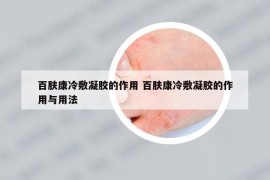 百肤康冷敷凝胶的作用 百肤康冷敷凝胶的作用与用法