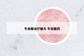 牛皮廨治疗偏方 牛皮廨药