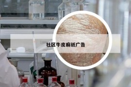 社区牛皮癣纸广告