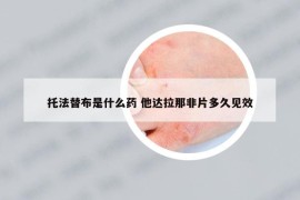 托法替布是什么药 他达拉那非片多久见效