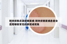 斑块状和点滴状银屑病 斑块状银屑病患者会出现哪些常见的表现或现象