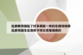 肚脐眼周围起了好多跟藓一样的东西特别痒 肚脐周围生出像疹子样红疙瘩很痒的