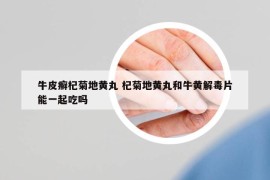 牛皮癣杞菊地黄丸 杞菊地黄丸和牛黄解毒片能一起吃吗