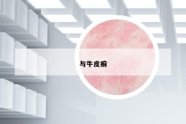 与牛皮癣