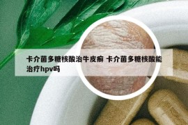 卡介菌多糖核酸治牛皮癣 卡介菌多糖核酸能治疗hpv吗