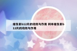 维生素b12片的功效与作用 利丰维生素b12片的功效与作用