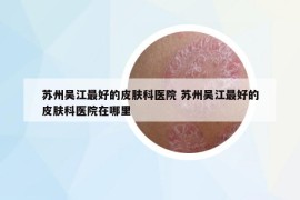 苏州吴江最好的皮肤科医院 苏州吴江最好的皮肤科医院在哪里