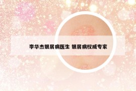 李华杰银屑病医生 银屑病权威专家
