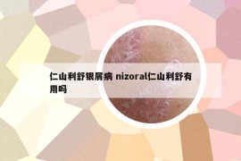 仁山利舒银屑病 nizoral仁山利舒有用吗