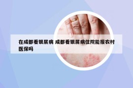 在成都看银屑病 成都看银屑病住院能报农村医保吗