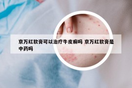京万红软膏可以治疗牛皮癣吗 京万红软膏是中药吗